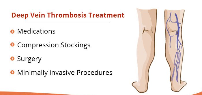 Are Compression Socks Good For Deep Vein Thrombosis? – Lasso® UK