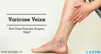 What Socks are Best for Varicose Veins?