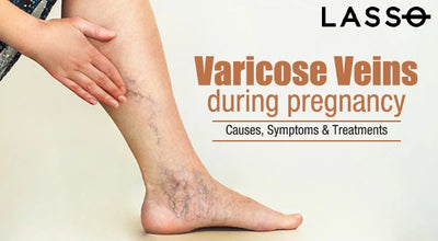How To Prevent Varicose Veins During Pregnancy?