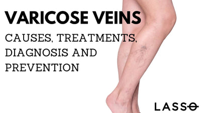 What is the Best way to Prevent Varicose Veins?