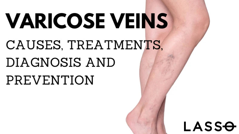 What is the Best way to Prevent Varicose Veins? – Lasso® UK by HOL